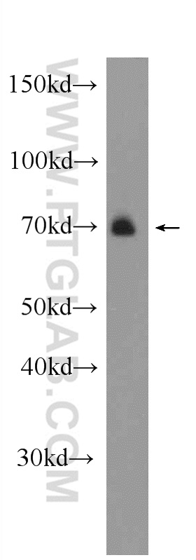 ARK5 Polyclonal antibody