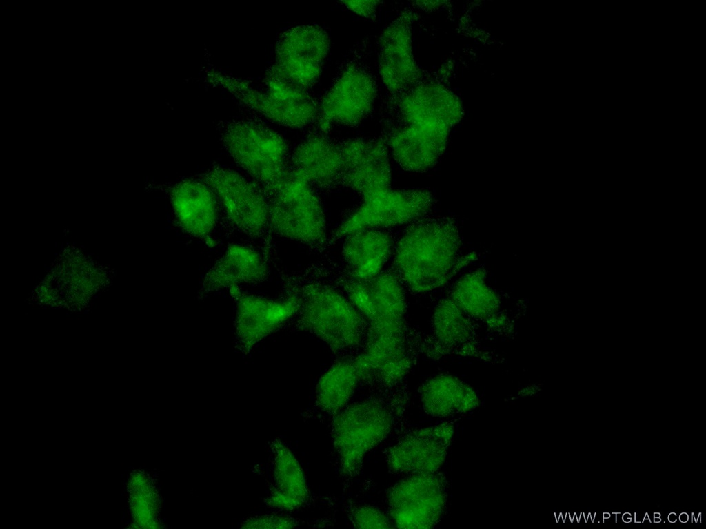 MIXL1 Polyclonal antibody