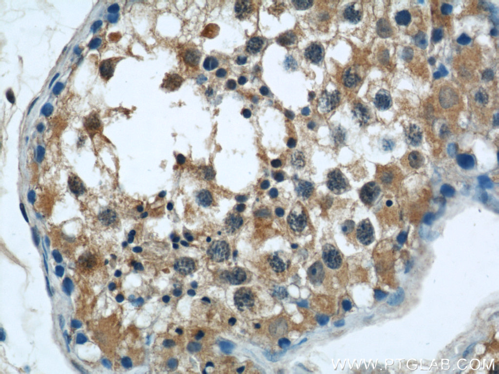 C7orf30 Polyclonal antibody