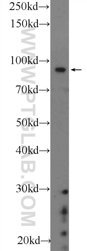 BARD1 Polyclonal antibody