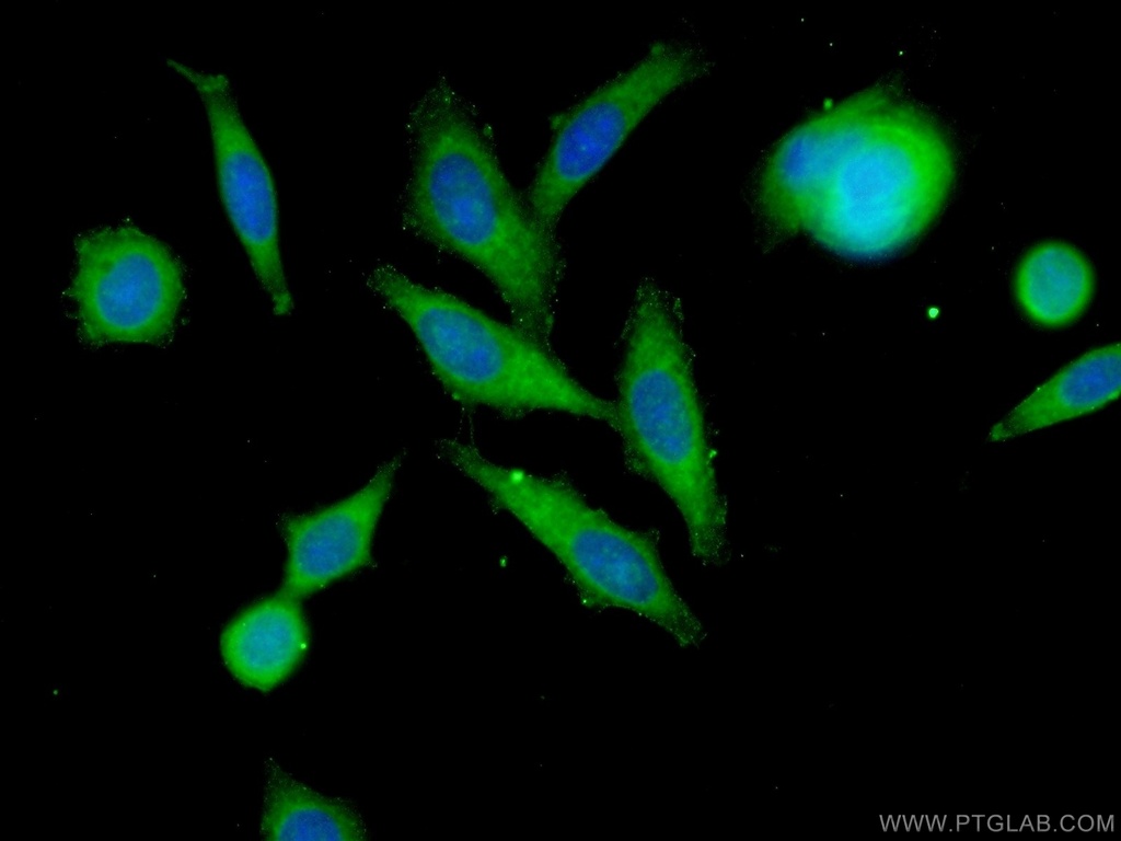 MMP12 Polyclonal antibody
