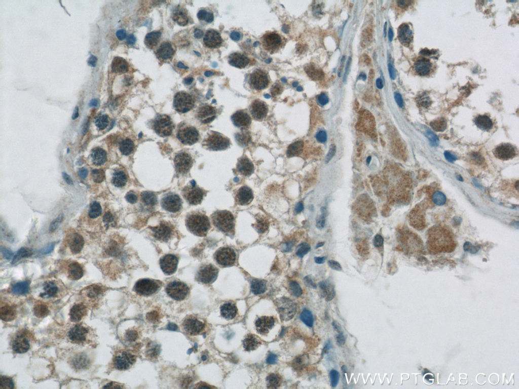 GBP6 Polyclonal antibody