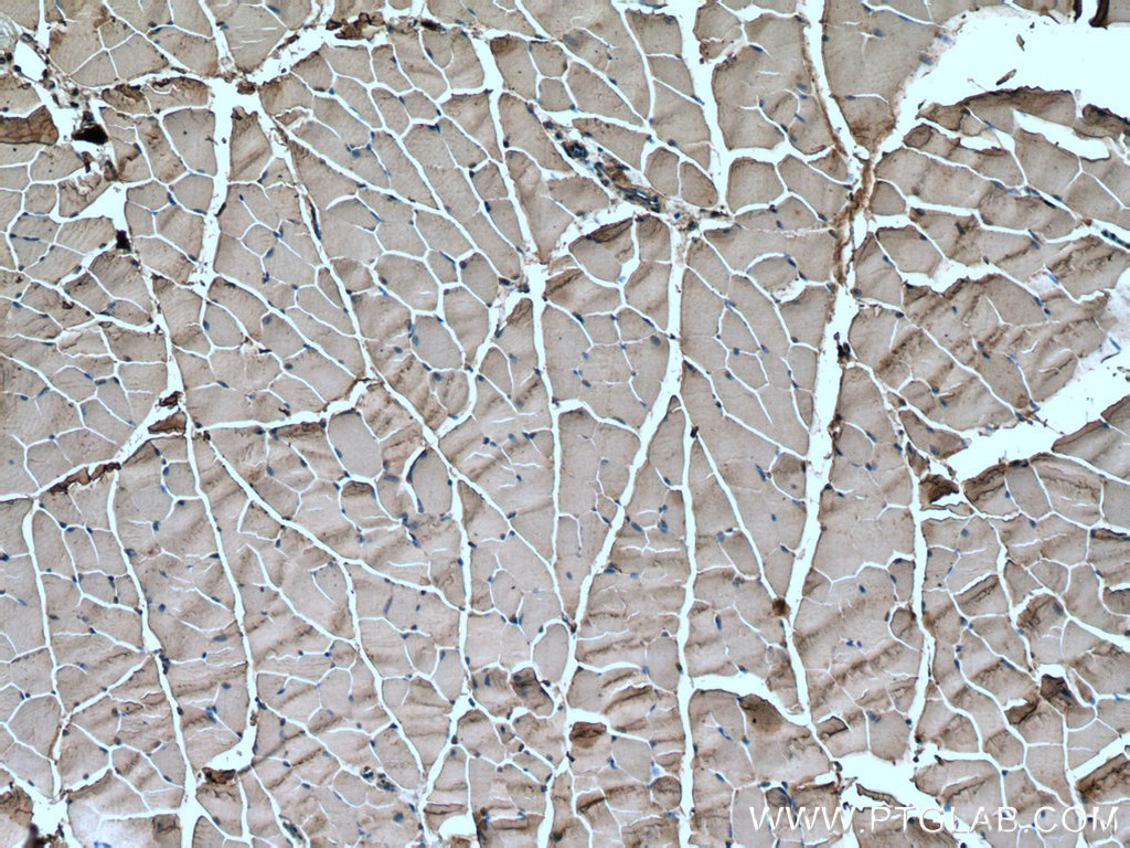 Nav1.5 Polyclonal antibody
