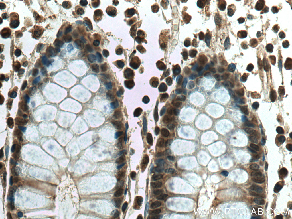 THAP11 Polyclonal antibody
