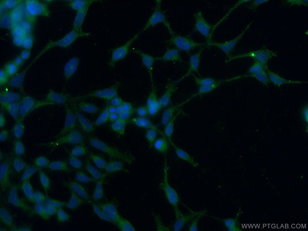 AKD1 Polyclonal antibody