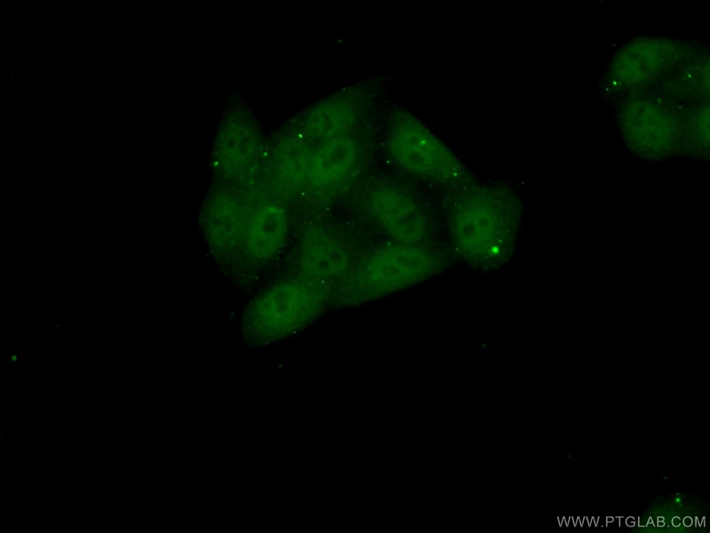 BEND3 Polyclonal antibody