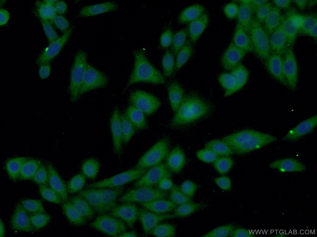 XRN1 Polyclonal antibody