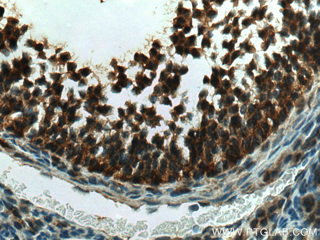 GLIS1 Polyclonal antibody