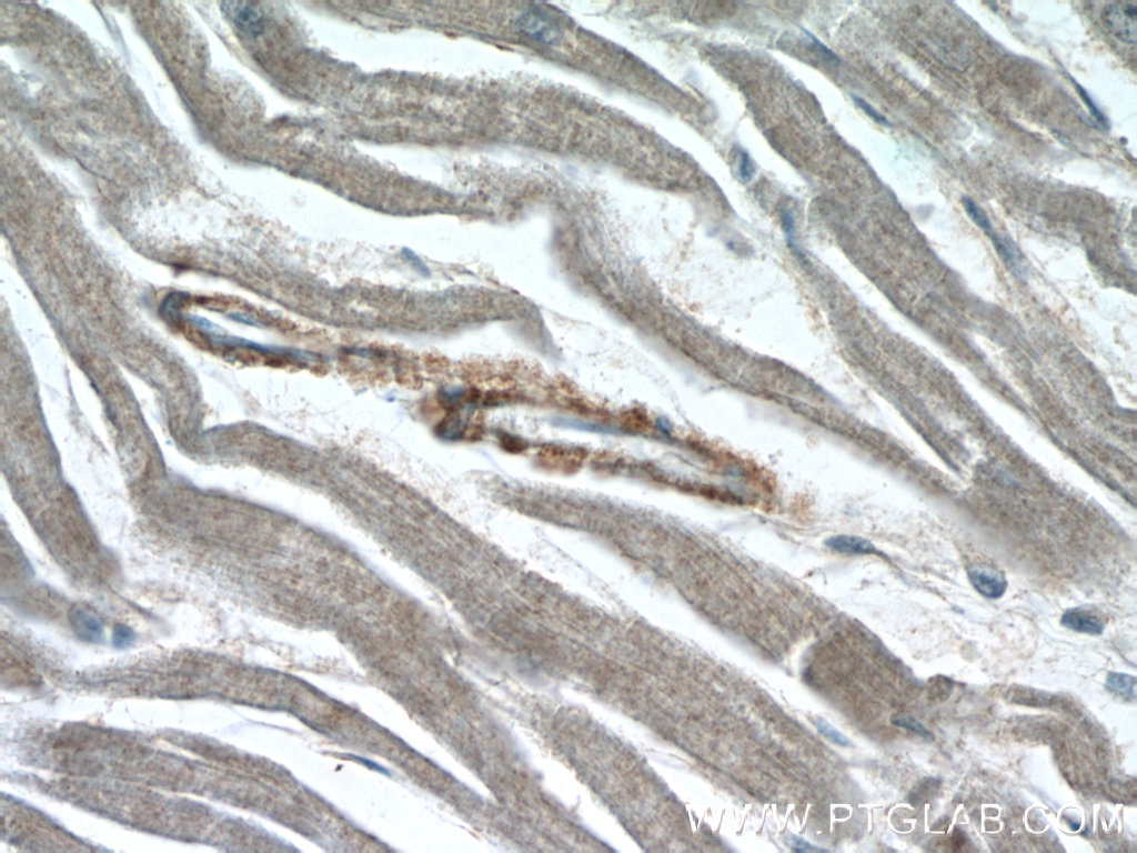 ZFYVE19 Polyclonal antibody