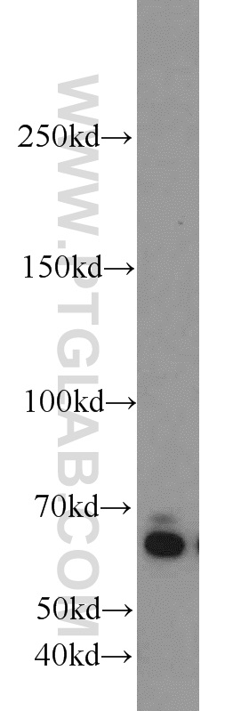 ZGPAT Polyclonal antibody