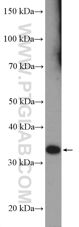 RSPH9 Polyclonal antibody