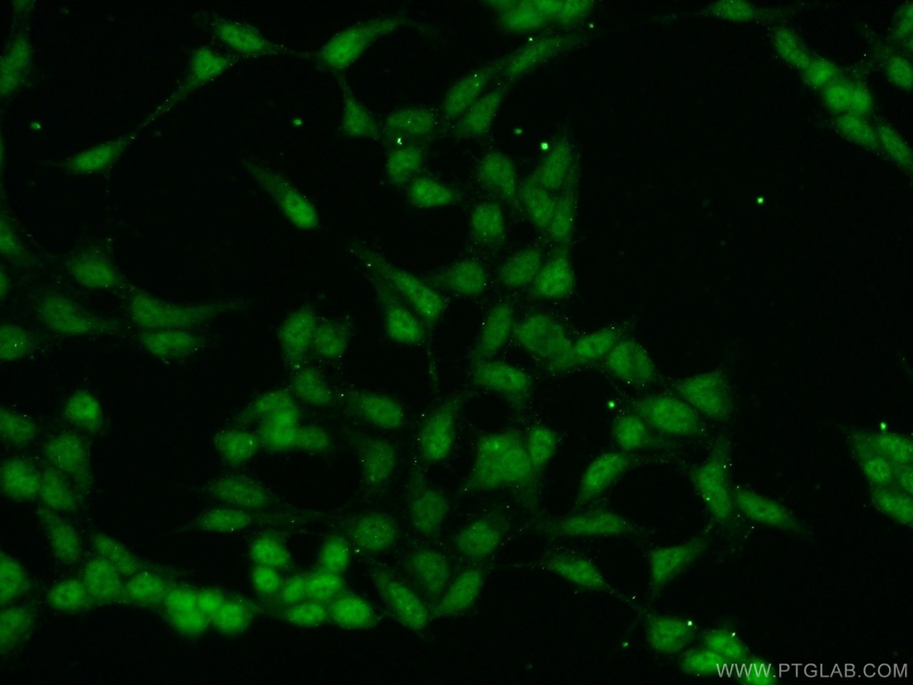 MAML3 Polyclonal antibody