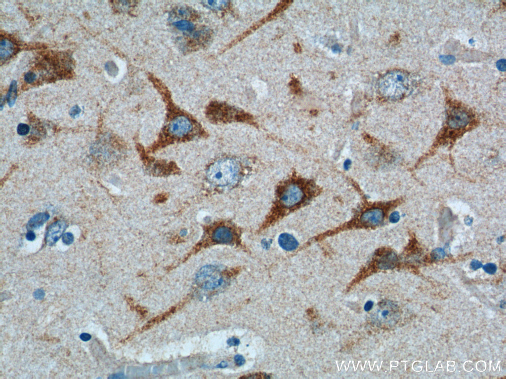 TRIF/TICAM1 Polyclonal antibody