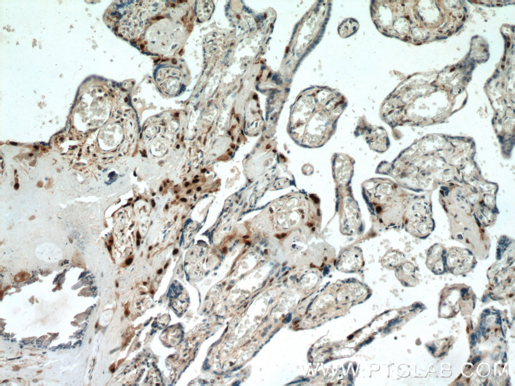 p57Kip2 Polyclonal antibody