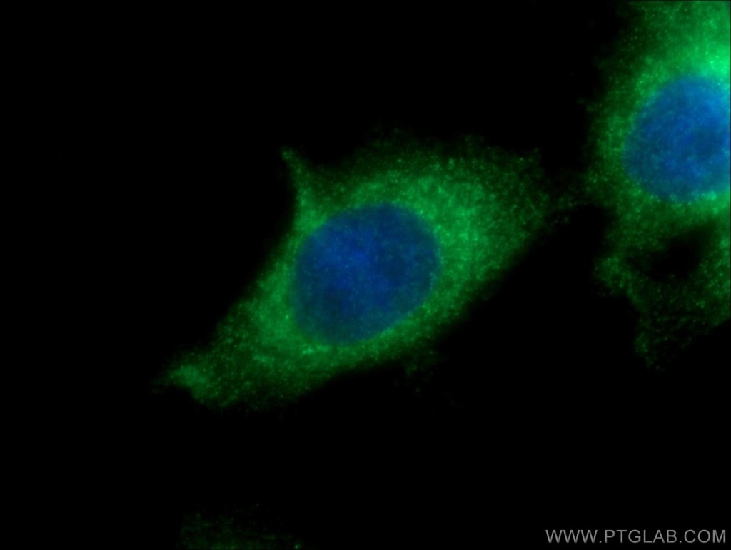 KDELC2 Polyclonal antibody