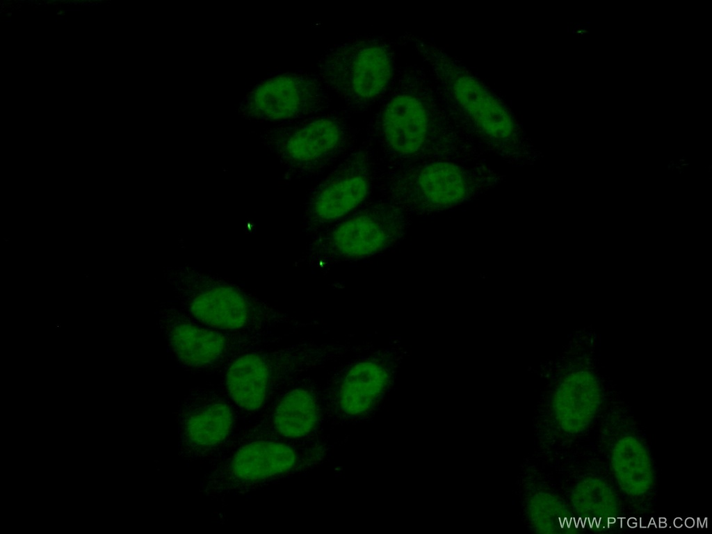 ZCCHC8 Polyclonal antibody