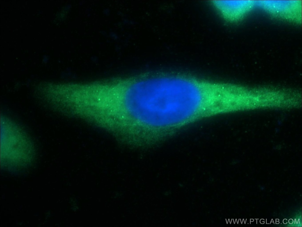 DNAJC21 Polyclonal antibody