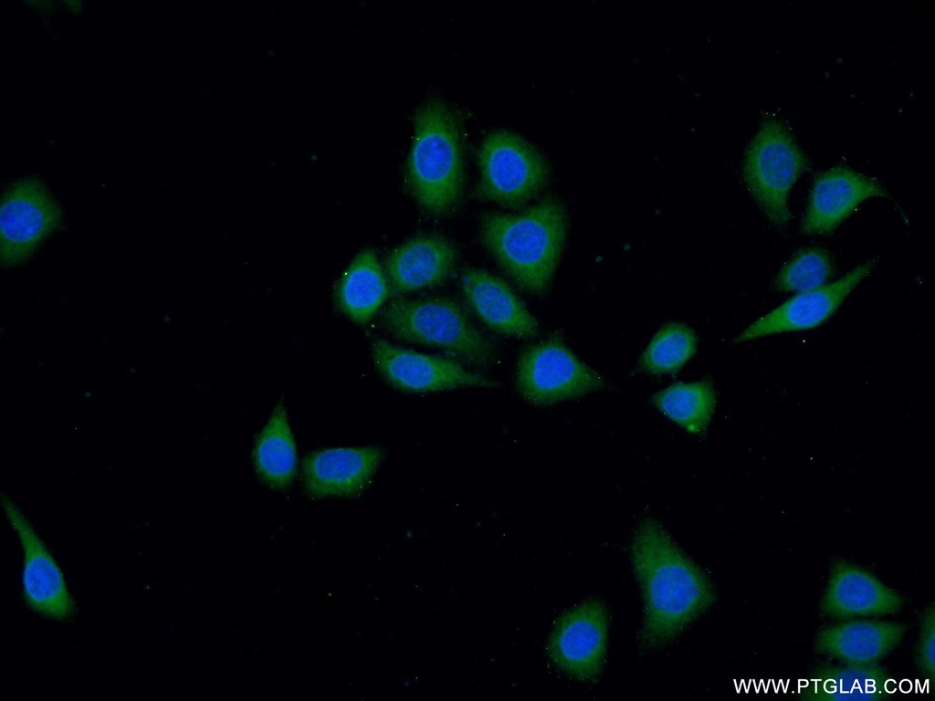 DOCK180 Polyclonal antibody