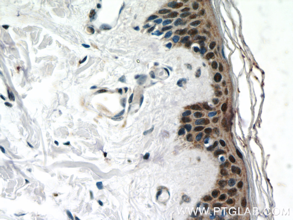 CBX6 Polyclonal antibody