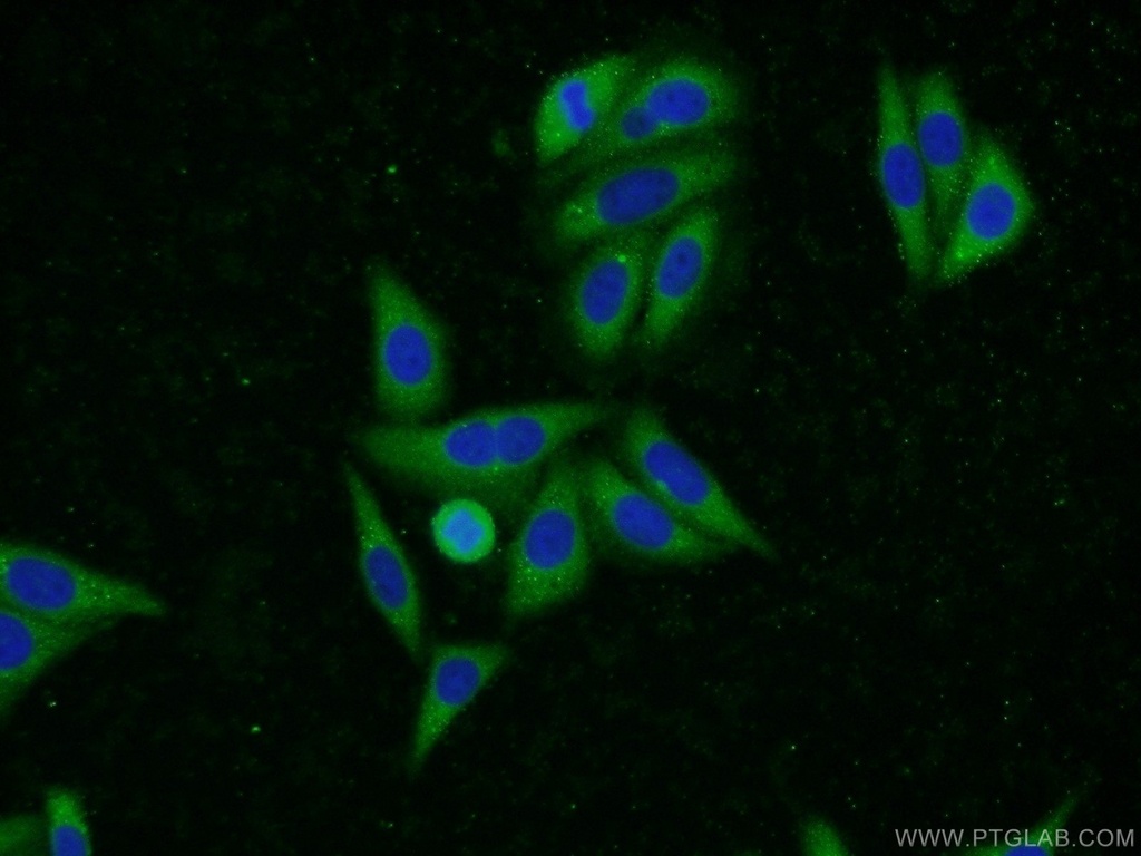 UBQLN2 Polyclonal antibody