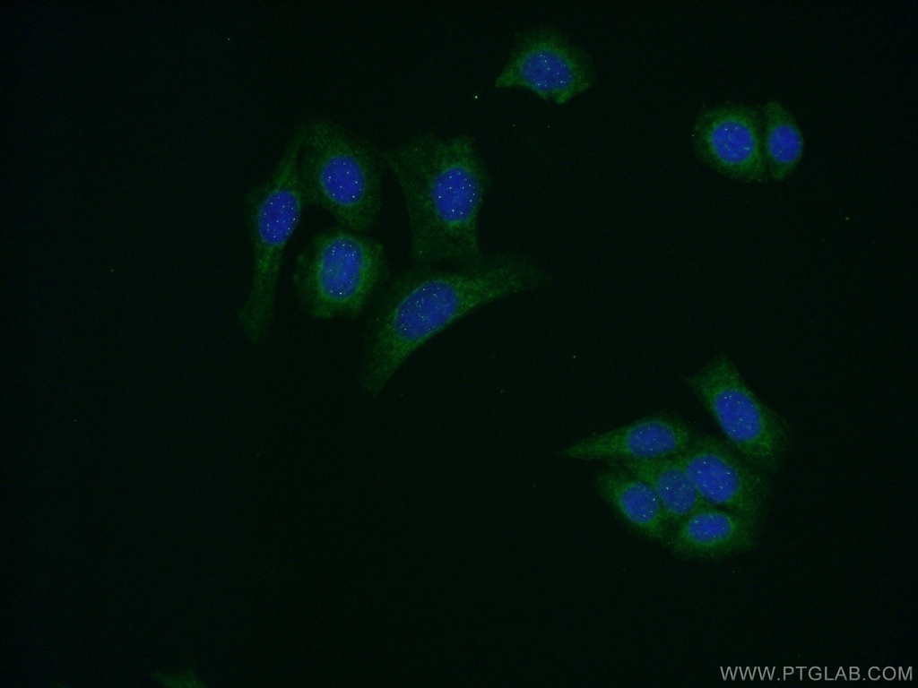 AMH Polyclonal antibody