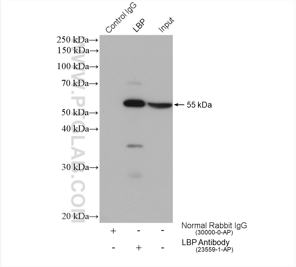 LBP Polyclonal antibody