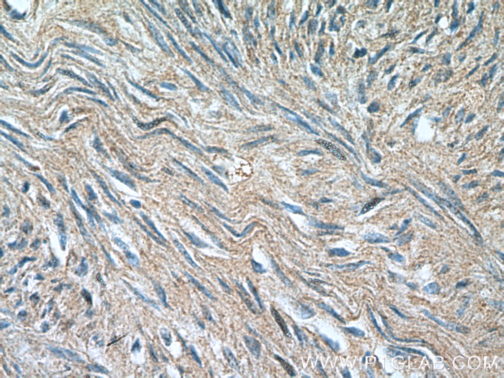 SMTN Polyclonal antibody