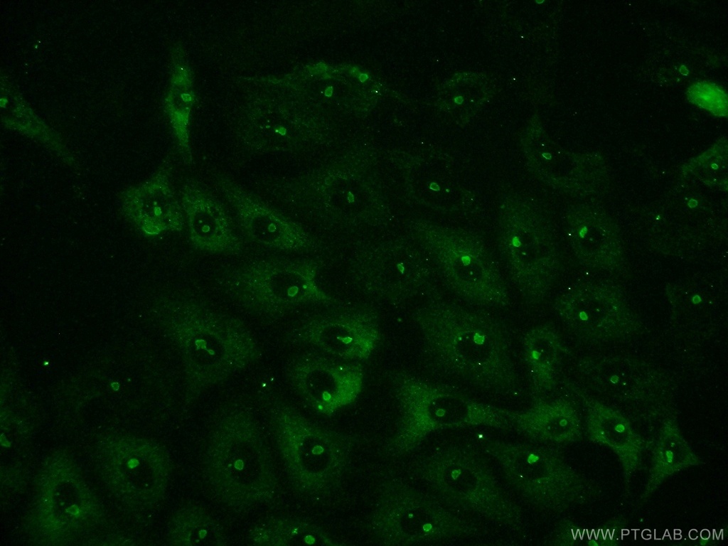 NFKB1 Polyclonal antibody