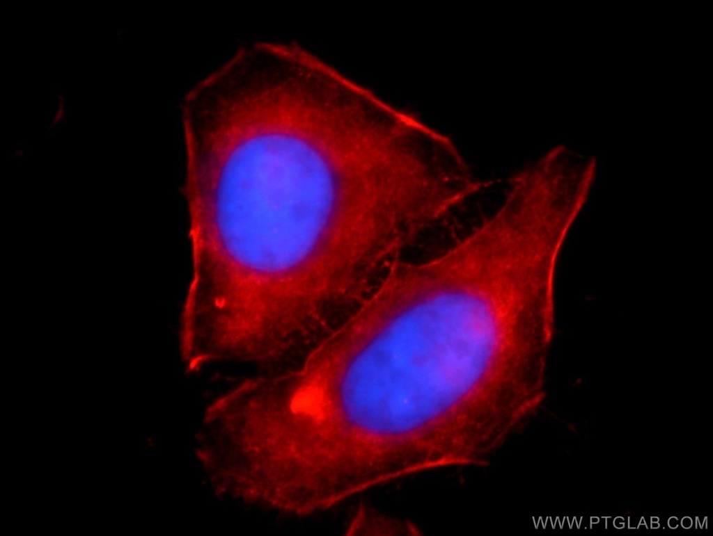 Alpha Actin Polyclonal antibody
