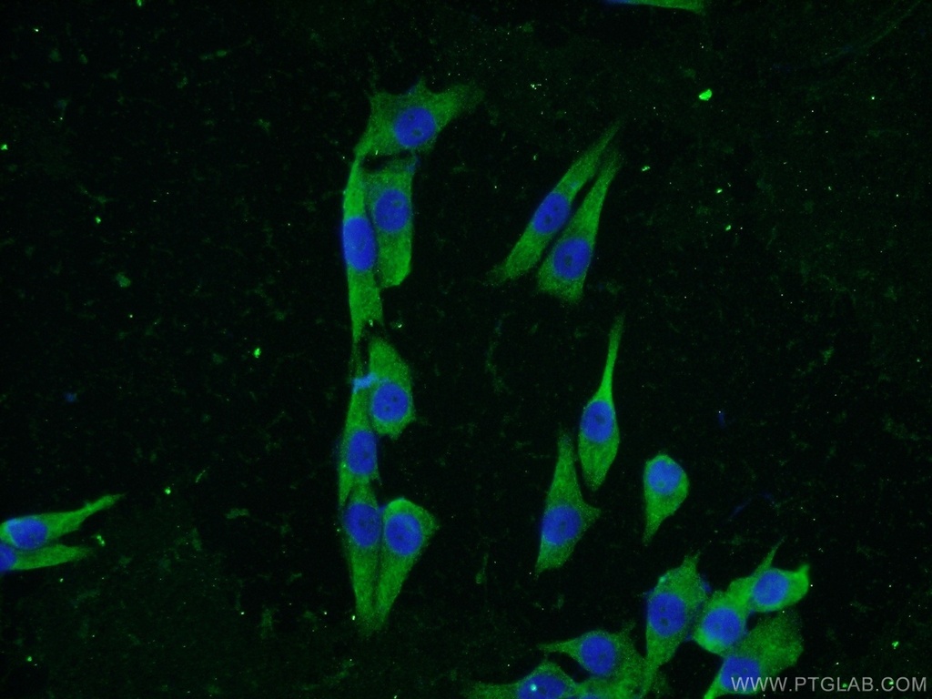 KCNK18 Polyclonal antibody