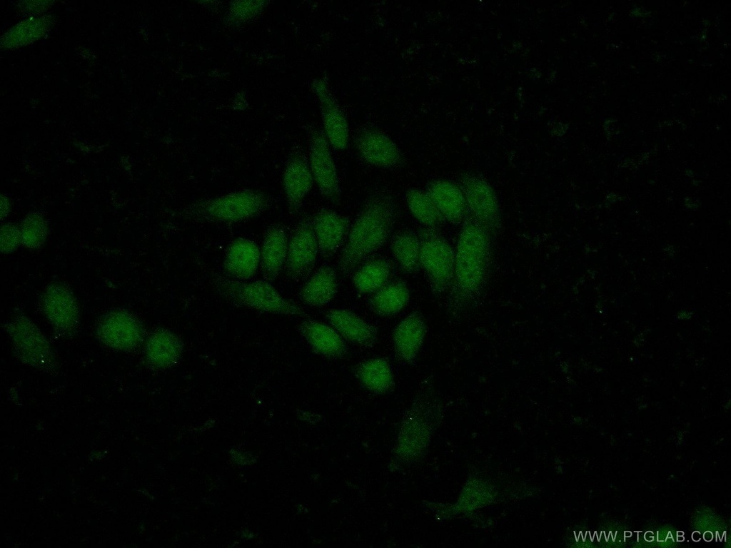 MNT Polyclonal antibody