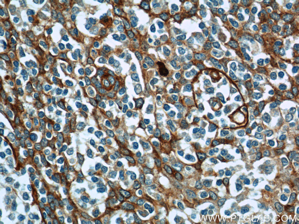 ADAM8 Polyclonal antibody