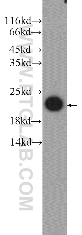 FATE1 Polyclonal antibody