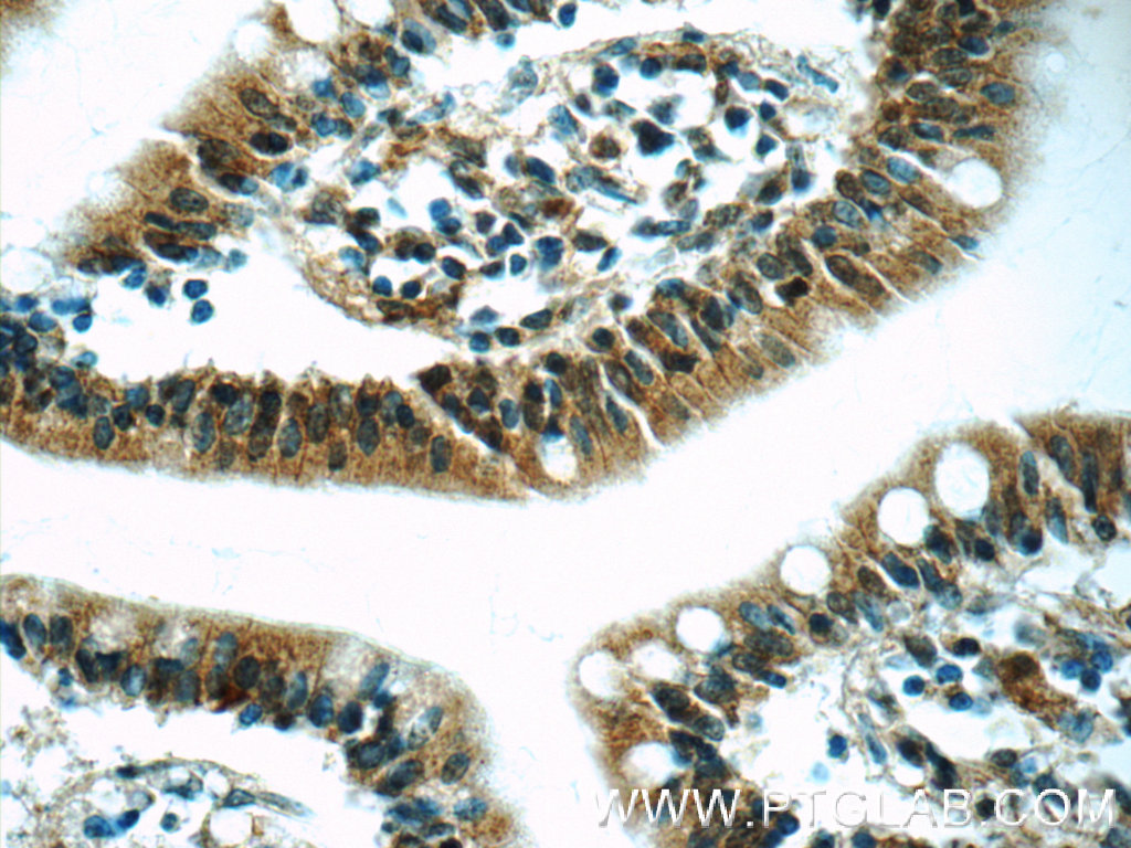 RSRC1 Polyclonal antibody