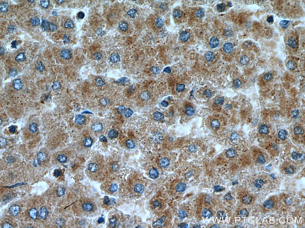 IER2 Polyclonal antibody