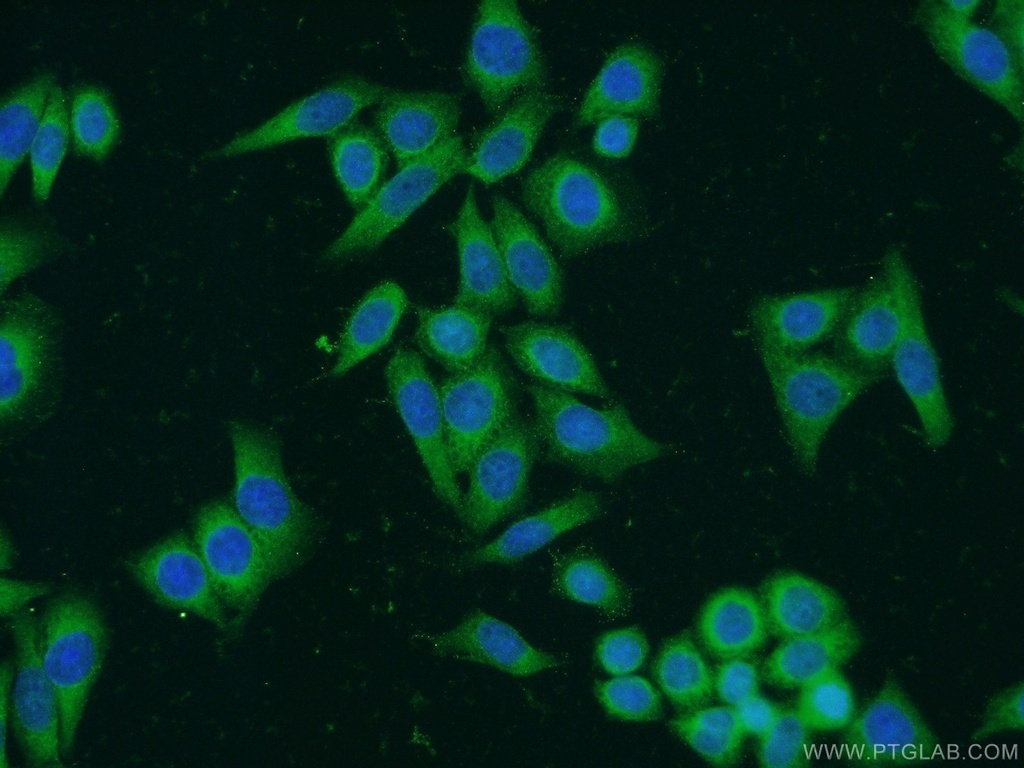 BCHE Polyclonal antibody