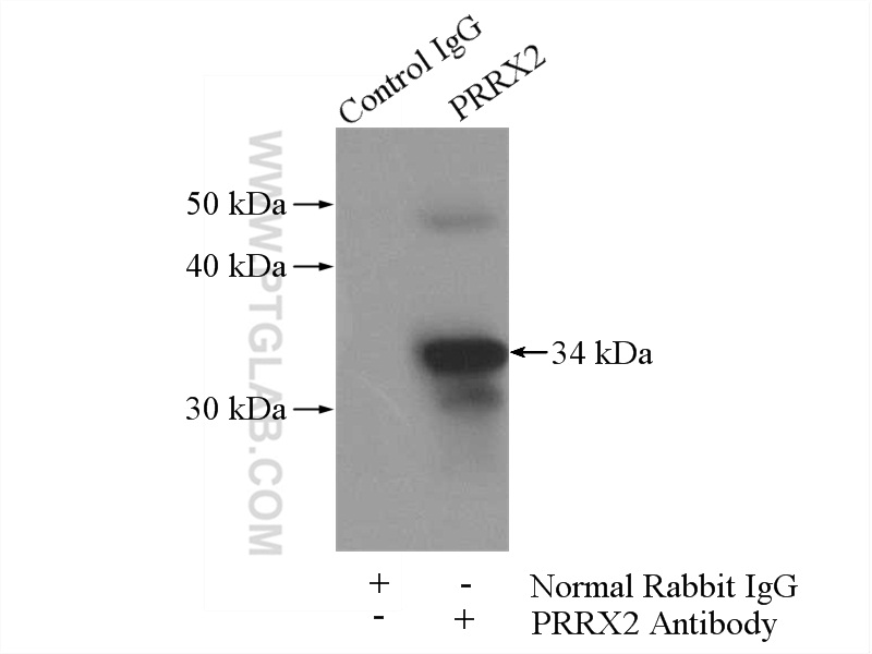 PRRX2 Polyclonal antibody