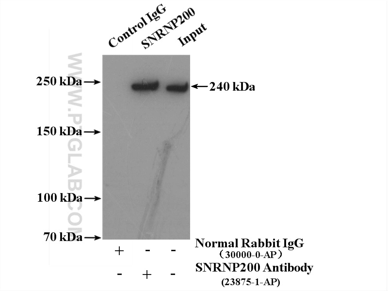SNRNP200 Polyclonal antibody