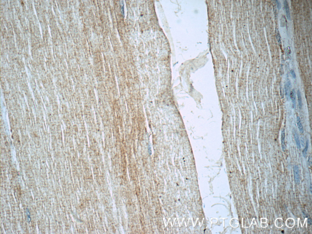 MYOZ3 Polyclonal antibody