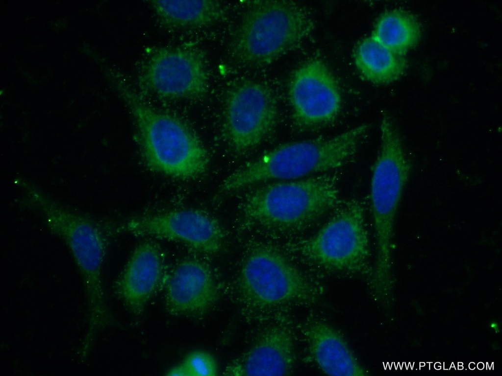 PPP2R5E Polyclonal antibody