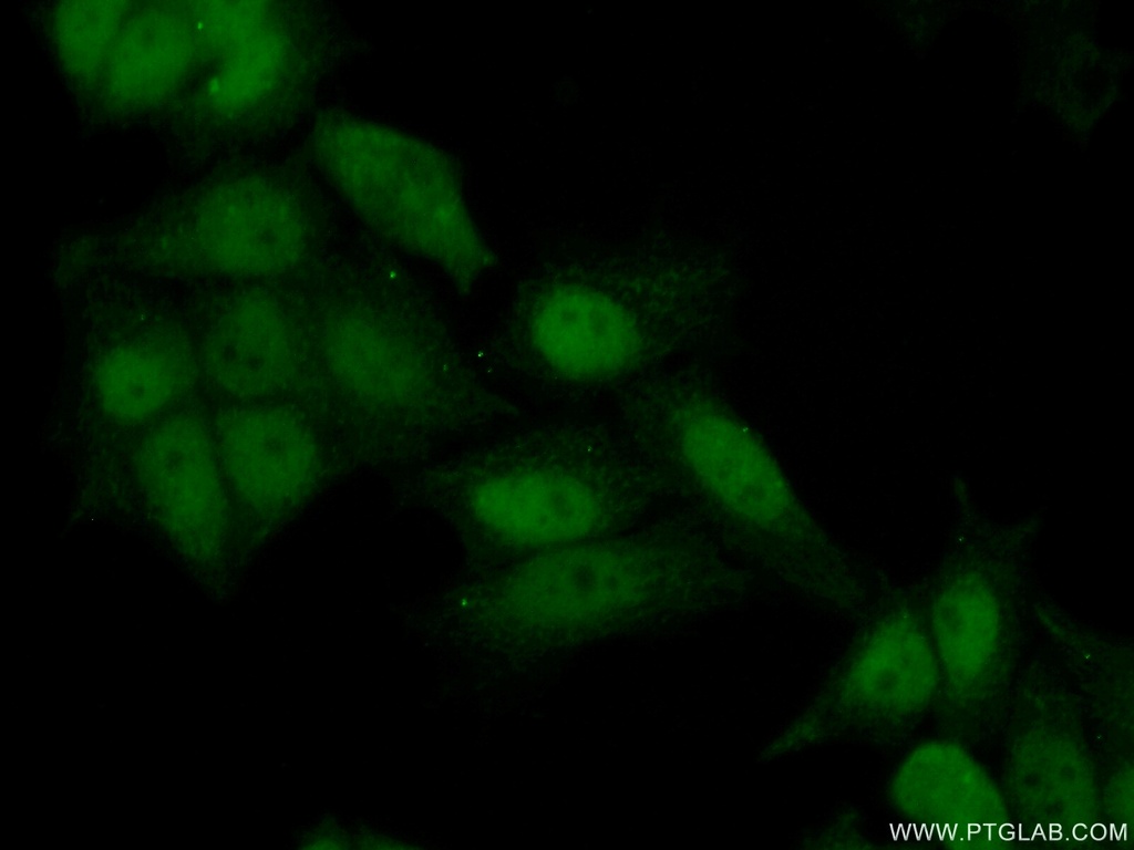 ATAD2 Polyclonal antibody