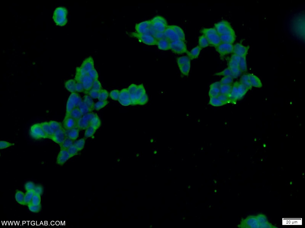 FAM158A Polyclonal antibody