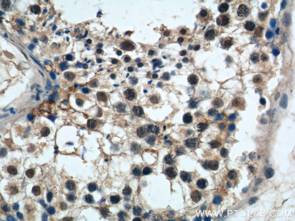 PRPF6 Polyclonal antibody