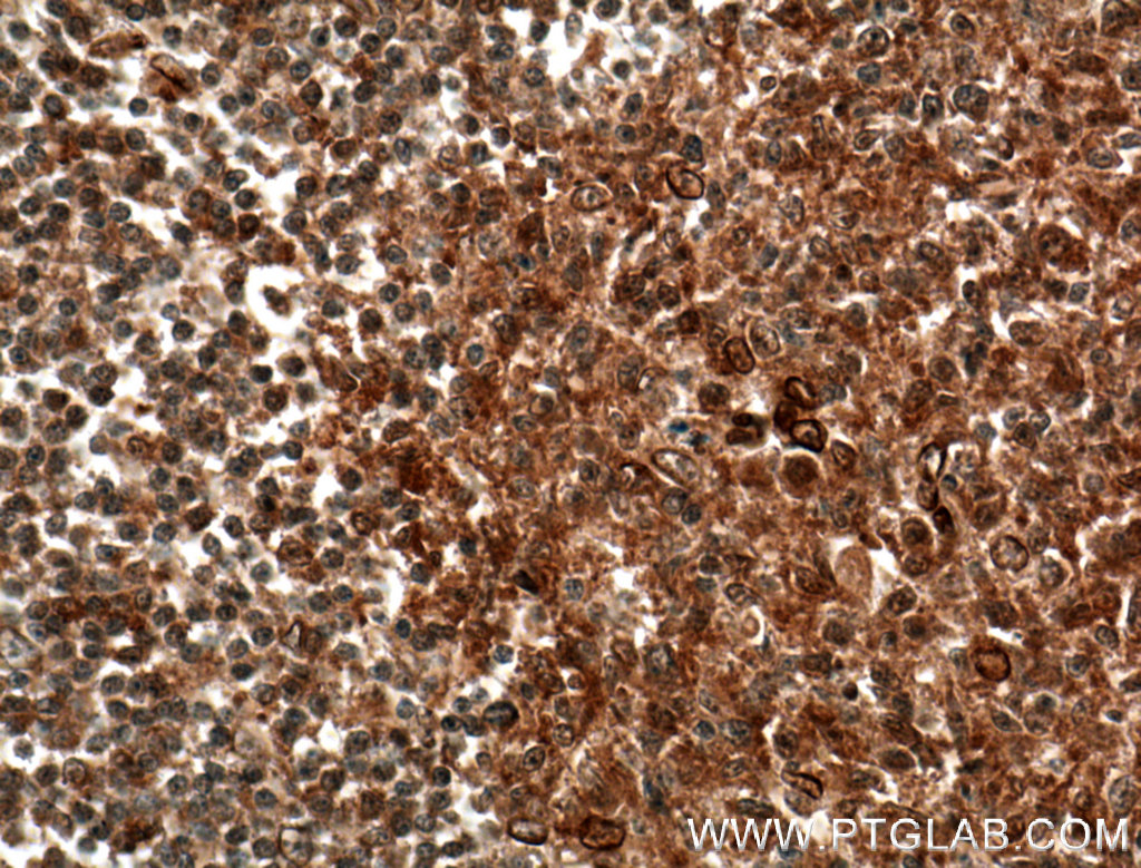 MAP4K1 Polyclonal antibody