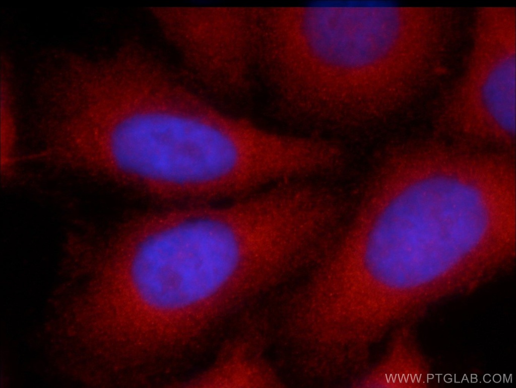 Angiotensinogen Polyclonal antibody