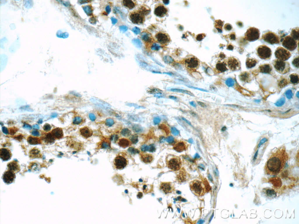 ANKRD13C Polyclonal antibody