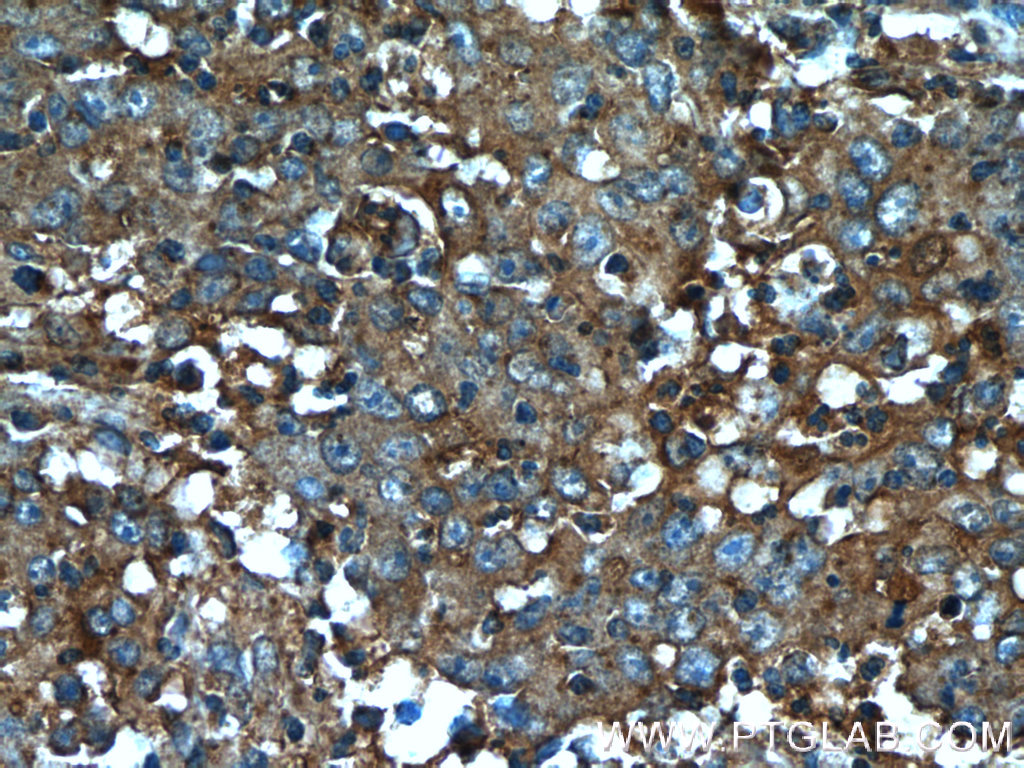 B4GALNT2 Polyclonal antibody