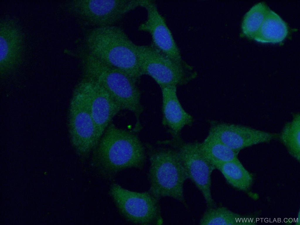 ANKRD27 Polyclonal antibody