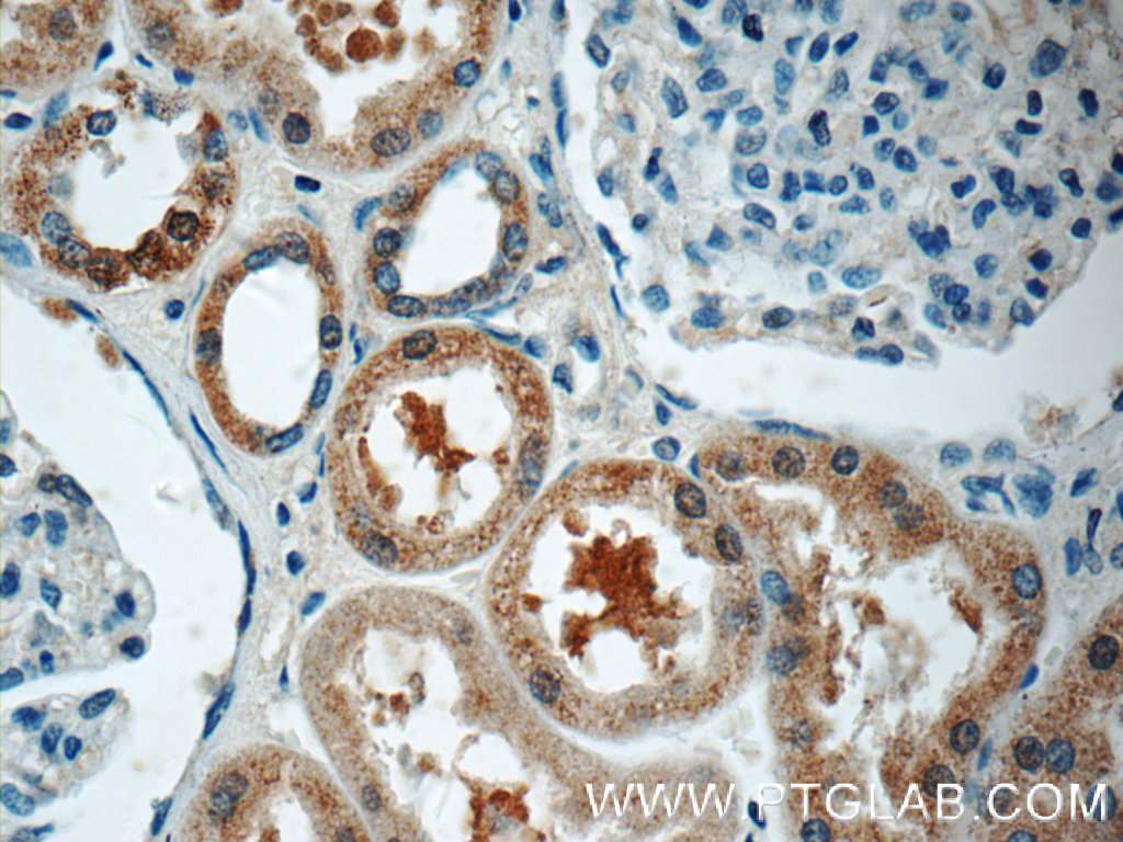 HSN2 Polyclonal antibody