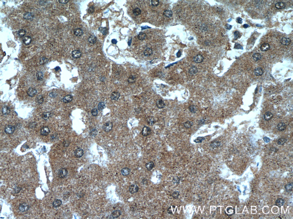 ANKS3 Polyclonal antibody